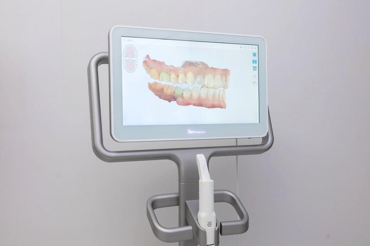 iTero/3D口腔内スキャナー